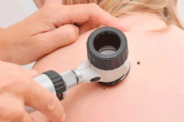 Curso Métodos Diagnósticos Aplicados às Lesões Amelanóticas e Queratinocíticas