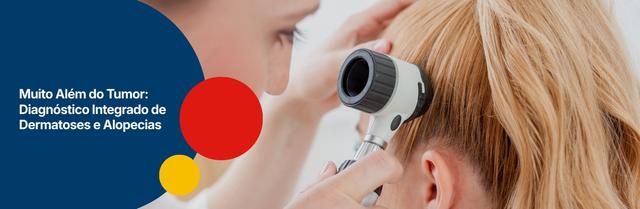 Muito Além do Tumor: Diagnóstico Integrado de Dermatoses e Alopecias